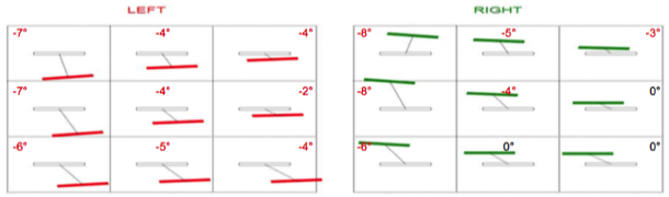 Diplopia Charting