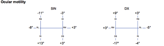 Diplopia Charting